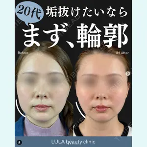 症例