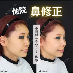 症例