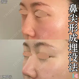 症例