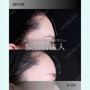 小倉美容外科/美容皮膚科 ビラビューティークリニック 大村 亞蘭医師の症例