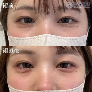 症例