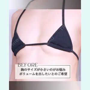 小倉美容外科/美容皮膚科 ビラビューティークリニック 大村 亞蘭医師の症例