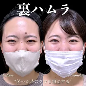 EMMO FACE CLINIC 大宮院 百瀬 直也医師の症例