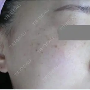 小倉美容外科/美容皮膚科 ビラビューティークリニック 大村 亞蘭医師の症例