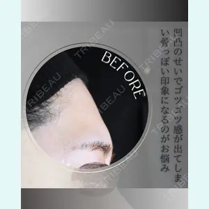 小倉美容外科/美容皮膚科 ビラビューティークリニック 大村 亞蘭医師の症例