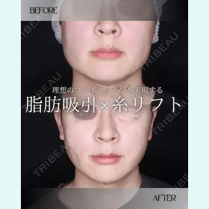 小倉美容外科/美容皮膚科 ビラビューティークリニック 大村 亞蘭医師の症例
