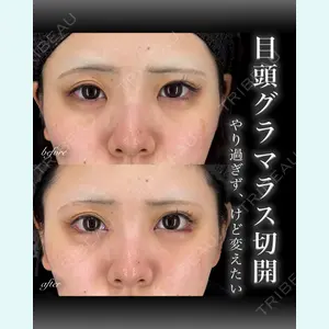 EMMO FACE CLINIC 大宮院 百瀬 直也医師の症例