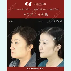 コントアクリニック 東京 福山 漱辰医師の症例