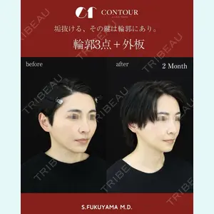 コントアクリニック 東京 福山 漱辰医師の症例
