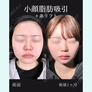 症例