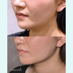 Shion Beauty Clinic 橋本 詩音医師の症例