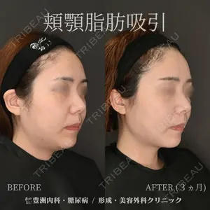 豊洲内科・糖尿病 / 形成・美容外科クリニック 澤口 悠医師の症例
