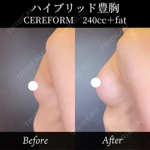 R Beauty CLINIC 銀座院 中西 友莉医師の症例
