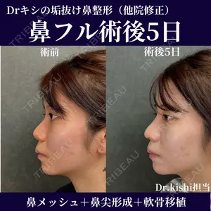 症例