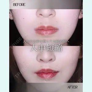小倉美容外科/美容皮膚科 ビラビューティークリニック 大村 亞蘭医師の症例