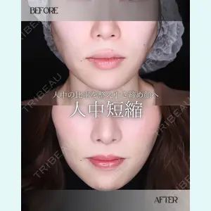 小倉美容外科/美容皮膚科 ビラビューティークリニック 大村 亞蘭医師の症例