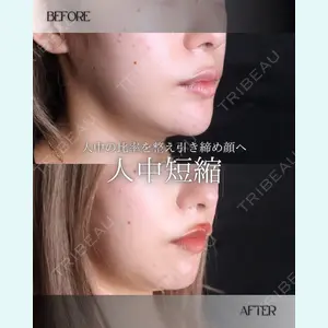 小倉美容外科/美容皮膚科 ビラビューティークリニック 大村 亞蘭医師の症例