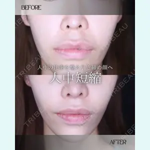 小倉美容外科/美容皮膚科 ビラビューティークリニック 大村 亞蘭医師の症例
