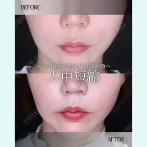 小倉美容外科/美容皮膚科 ビラビューティークリニック 大村 亞蘭医師の症例