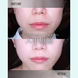 小倉美容外科/美容皮膚科 ビラビューティークリニック 大村 亞蘭医師の症例