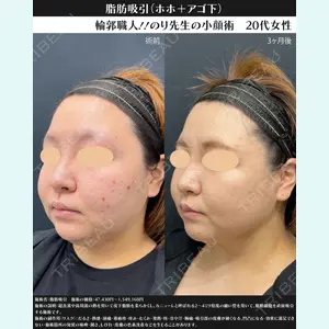 湘南美容クリニック 川崎院 伊藤 賀敏医師の症例