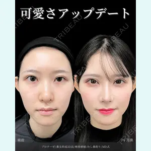 症例