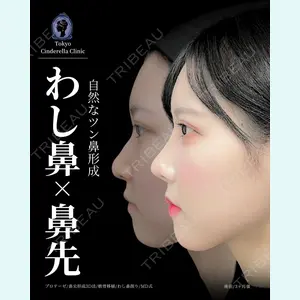 症例
