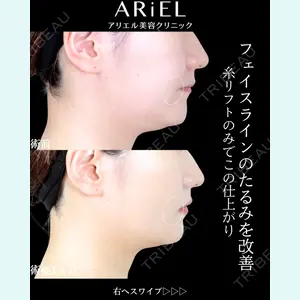 アリエル美容クリニック 横浜院 渡邉 光医師の症例