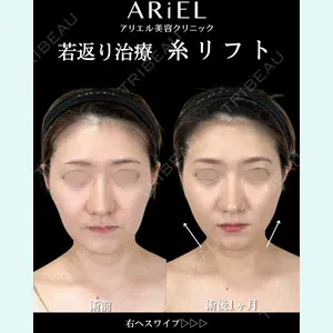 アリエル美容クリニック 横浜院 渡邉 光医師の症例