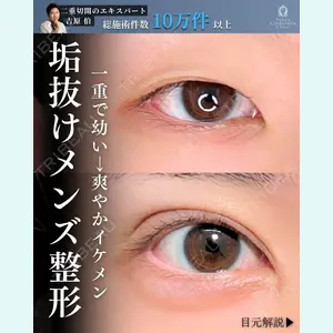 症例