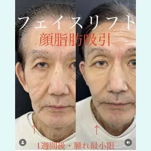 症例