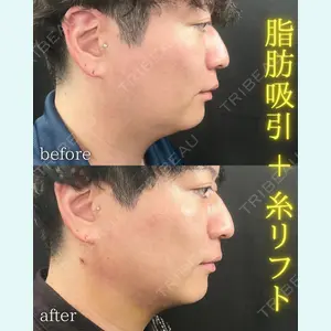 THE FIRST CLINIC 町田院 木暮 啓一郎医師の症例