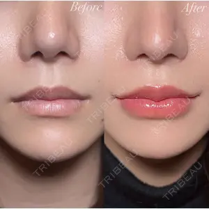 R Beauty CLINIC 銀座院 村山史朗医師の症例