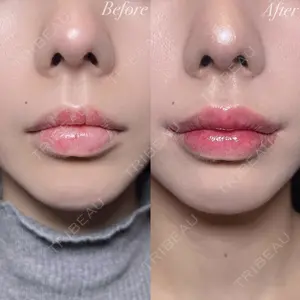 R Beauty CLINIC 銀座院 村山史朗医師の症例