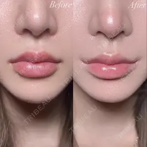 R Beauty CLINIC 銀座院 村山史朗医師の症例