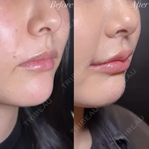 R Beauty CLINIC 銀座院 村山史朗医師の症例