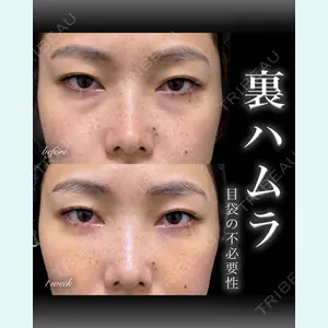 EMMO FACE CLINIC 大宮院 百瀬 直也医師の症例