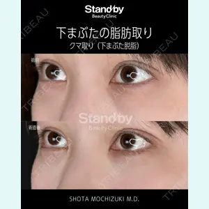 症例