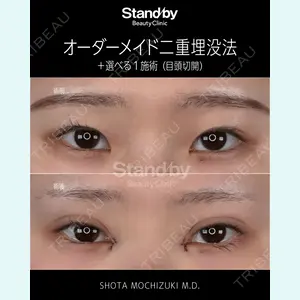 症例