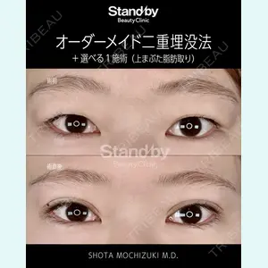 症例