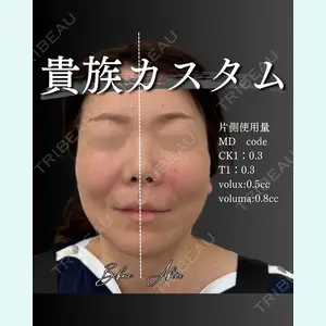 症例