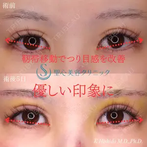 聖心美容クリニック 六本木院 菱田 健作医師の症例