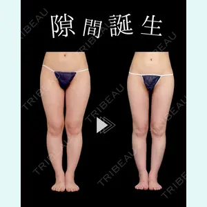 症例