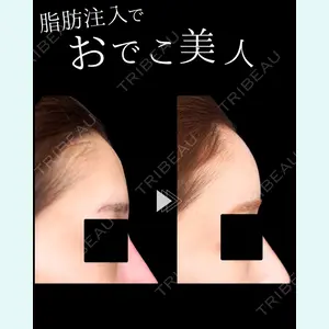 症例