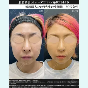 湘南美容クリニック 川崎院 伊藤 賀敏医師の症例