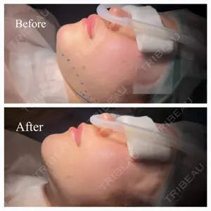 Shion Beauty Clinic 橋本 詩音医師の症例
