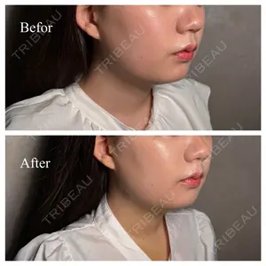 Shion Beauty Clinic 橋本 詩音医師の症例