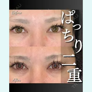 症例