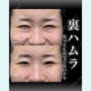 EMMO FACE CLINIC 大宮院 百瀬 直也医師の症例