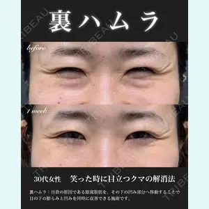 EMMO FACE CLINIC 大宮院 百瀬 直也医師の症例